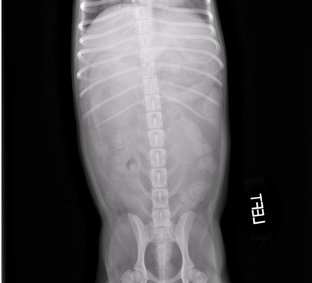 Ventro-dorsal radiograph of a dog with acute pancreatitis. Note the right lateral displacement of the duodenum and the left displacement of the pyloris in this view.